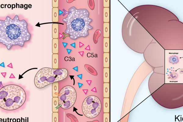 Media Solutions; Illustration; University of Wisconsin; School of Medicine and Public Health; UW-Madison; Scientific Illustration; Injury/Inflammation